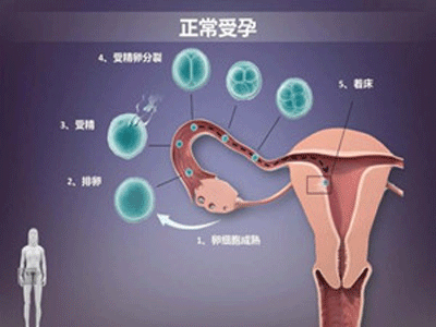 人工受孕费用多少