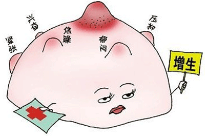 乳腺有结节怎么治疗