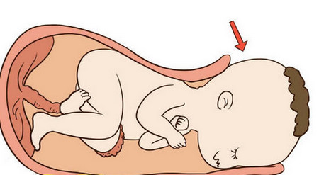 分娩方式决定孩子未来，顺产和剖腹产区别居然