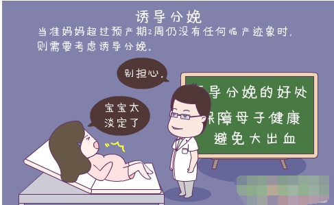 什么叫做诱导分娩法