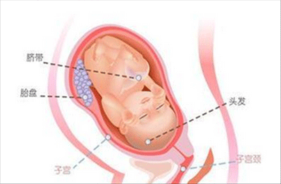 孕晚期入盆症状