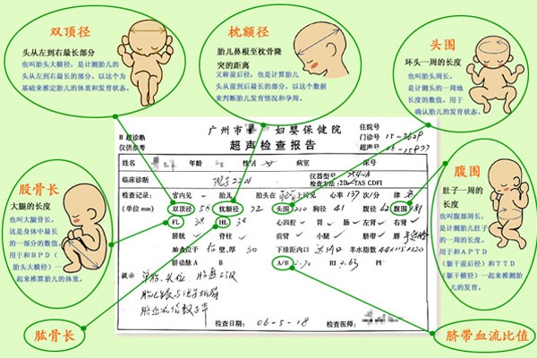 教你学看b超单