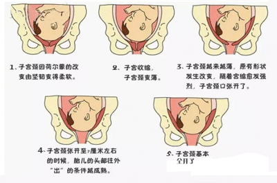 胎头入盆后多久会生