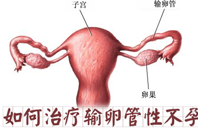 输卵管不孕怎么回事