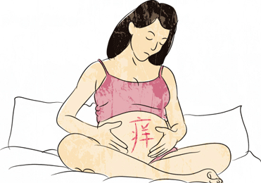 孕妇湿疹症状