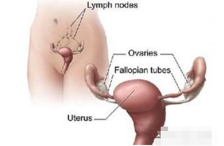 附件炎对生育的影响