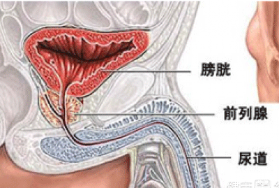 如何预防非淋性尿道炎