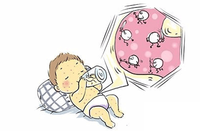 如何预防婴儿湿疹