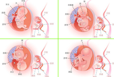 怀孕17周肚子有多大