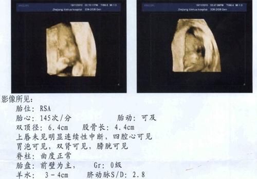 做三维b超注意事项