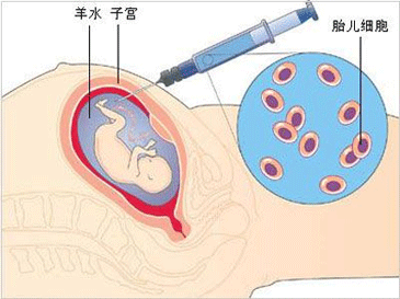 血性羊水的危害